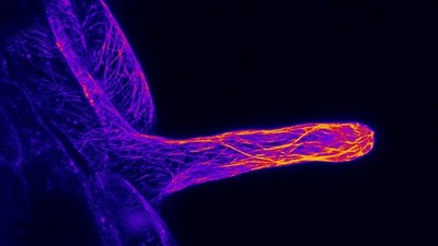 植物の根毛側面を硬くするしくみの解明に成功～根の毛はなぜまっすぐに伸びる？～